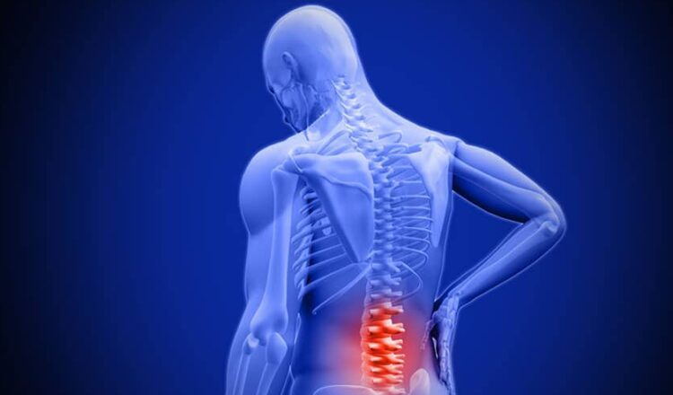 Expert Advises Nigerians Against Delaying Treatment For Back, Neck Pain